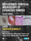 Reflectance Confocal Microscopy of Cutaneous Tumors - eBook