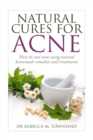 Natural cures for acne : How to cure acne using natural homemade remedies and treatments - Book