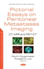Pictorial Essays on Peritoneal Metastases Imaging: CT, MRI and PET-CT - eBook