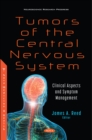Tumors of the Central Nervous System: Clinical Aspects and Symptom Management - eBook