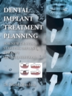 Dental Implant Treatment Planning for New Dentists Starting Implant Therapy - eBook