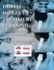Dental Implant Treatment Planning for New Dentists Starting Implant Therapy - Book