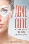 Acne Cure Clear Skin For Life - Book