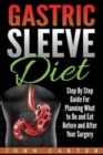 Gastric Sleeve Diet : Step By Step Guide For Planning What to Do and Eat Before and After Your Surgery - Book