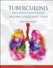 Tuberculosis and Nontuberculous Mycobacterial Infections - Book