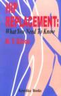 Hip Replacement : What You Need to Know - Book