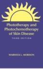 Phototherapy and Photochemotherapy for Skin Disease - Book