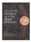 Atlas of Minimal Access Spine Surgery - Book