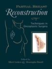 Partial Breast Reconstruction : Techniques in Oncoplastic Surgery - Book