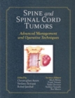 Spine and Spinal Cord Tumors : Advanced Management and Operative Techniques - Book
