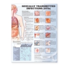 Sexually Transmitted Infections Anatomical Chart - Book
