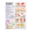 Understanding Allergies Anatomical Chart in Spanish (Entendiendo Las Alergias) - Book