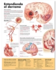 Understanding Stroke Anatomical Chart in Spanish (Entendiendo que es un derrame) - Book