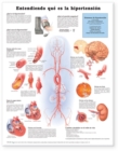 Understanding Hypertension Anatomical Chart in Spanish (Entendiendo Que Es la Hypertension) - Book