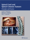 Spinal Cord and Spinal Column Tumors : Principles and Practice - Book