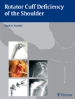 Rotator Cuff Deficiency of the Shoulder - Book