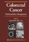 Colorectal Cancer : Multimodality Management - eBook