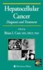 Hepatocellular Carcinoma : Diagnosis and Treatment - eBook