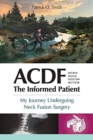Acdf : The Informed Patient: My Journey Undergoing Neck Fusion Surgery - Book