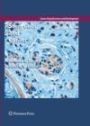 Stem Cells and Cancer - eBook