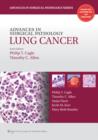 Advances in Surgical Pathology: Lung Cancer - Book