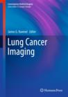 Lung Cancer Imaging - Book