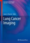 Lung Cancer Imaging - eBook