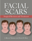 Facial Scars : Surgical Revision and Treatment - eBook