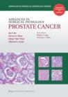 Advances in Surgical Pathology: Prostate Cancer - Book