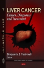 Liver Cancer : Causes, Diagnosis & Treatment - Book