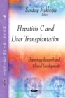 Hepatitis C Virus : Epidemiology, Pathogenesis and Treatment - eBook