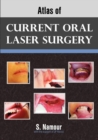 Atlas of Current Oral Laser Surgery - Book