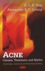 Acne : Causes, Treatment & Myths - Book