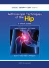 Arthroscopic Techniques of the Hip : A Visual Guide - eBook