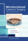 Microincisional Cataract Surgery : The Art and Science - eBook