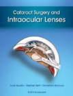 Cataract Surgery and Intraocular Lenses - Book