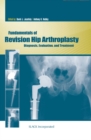 Fundamentals of Revision Hip Arthroplasty : Diagnosis, Evaluation, and Treatment - eBook
