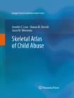 Skeletal Atlas of Child Abuse - Book