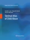 Skeletal Atlas of Child Abuse - eBook