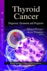 Thyroid Cancer : Diagnosis, Treatment & Prognosis - Book