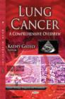 Lung Cancer : A Comprehensive Overview - Book
