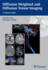 Diffusion Weighted and Diffusion Tensor Imaging : A Clinical Guide - Book