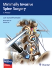 Minimally Invasive Spine Surgery : A Primer - Book