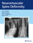 Neuromuscular Spine Deformity - Book