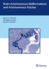 Brain Arteriovenous Malformations and Arteriovenous Fistulas - Book
