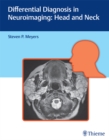 Differential Diagnosis in Neuroimaging: Head and Neck : Head and Neck - eBook