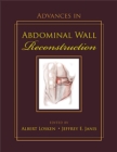 Advances in Abdominal Wall Reconstruction - Book