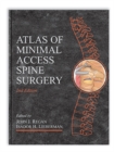 Atlas of Minimal Access Spine Surgery - Book