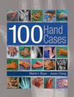 100 Hand Cases - Book