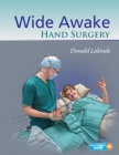 Wide Awake Hand Surgery - Book